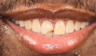 Smile Village Dental Care | Digital Radiography, VELscope reg  Cancer Screening and Implant Restorations