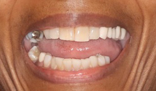 Smile Village Dental Care | Preventative Program, ClearCorrect reg  and Juvederm reg 