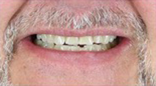 Smile Village Dental Care | VELscope reg  Cancer Screening, Digital Radiography and Dermal Fillers